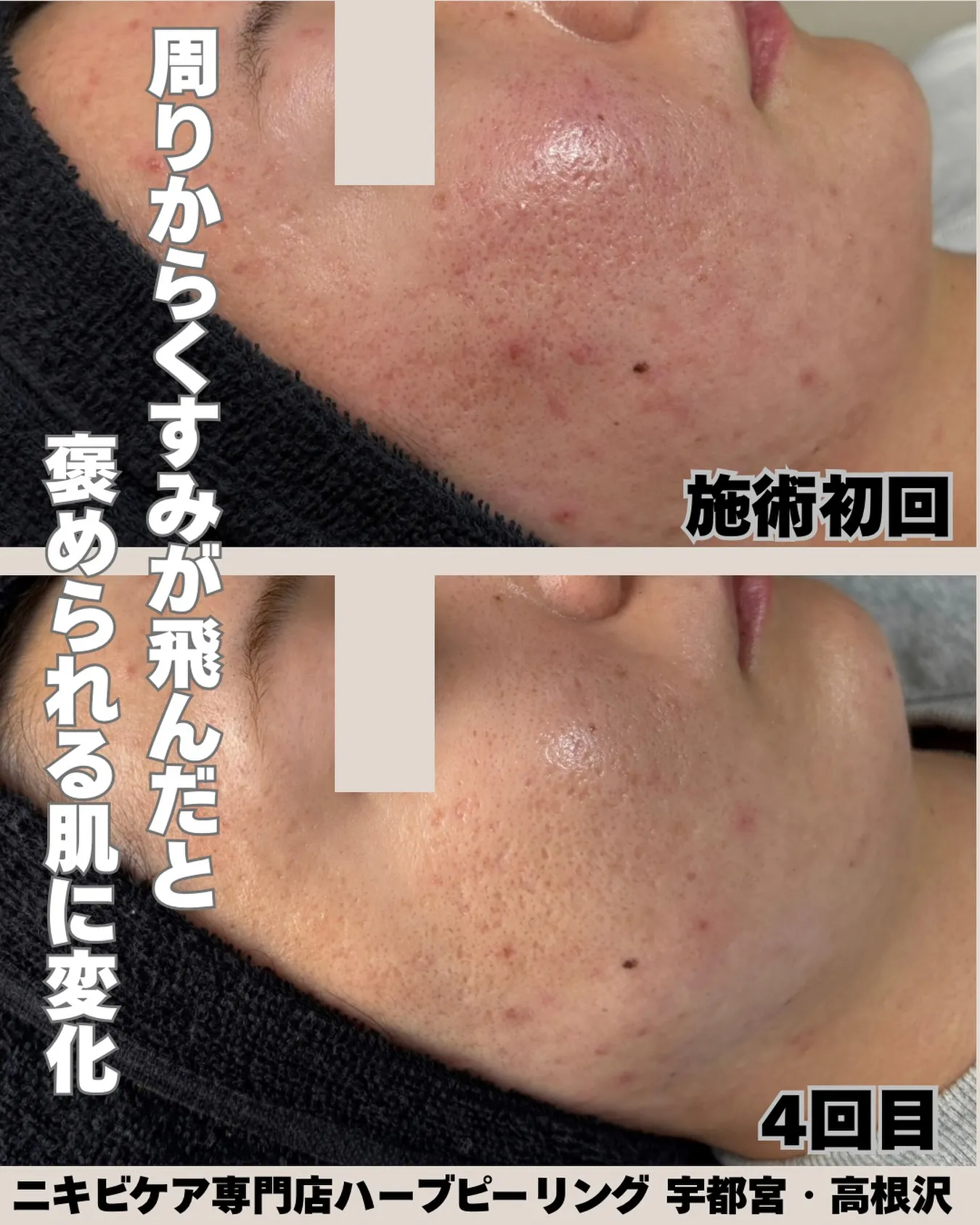 「周りから、肌キレイになったねって言われました✨」